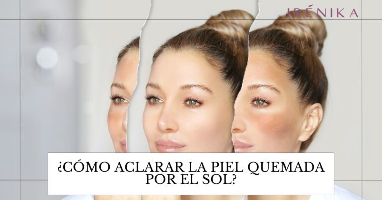 como aclarar la piel quemada por el sol